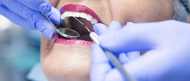 Best Emergency Root Canal Treatment in Pleasant Hill, TX